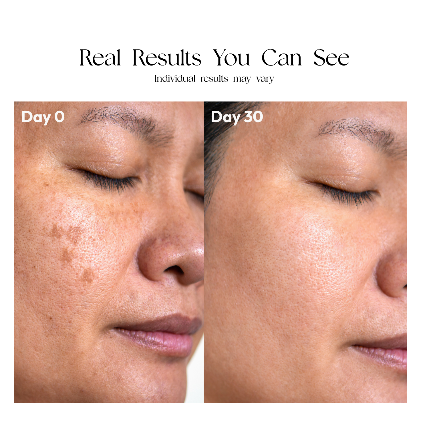 Radiant Pro LED Face Mask with Red, Blue, and Near-Infrared Light Therapy